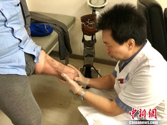 以工匠精神“造假”他们让截肢者的人生更完整